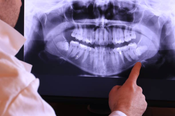 Best Emergency Dental Care for Broken or Chipped Teeth in Fenton, MI