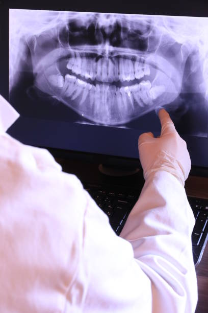 Best Emergency Gum Treatment in Fenton, MI